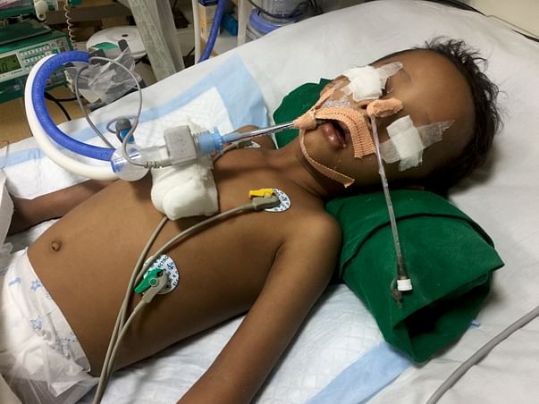 Help 3 Year Old Asad Open His Eyes