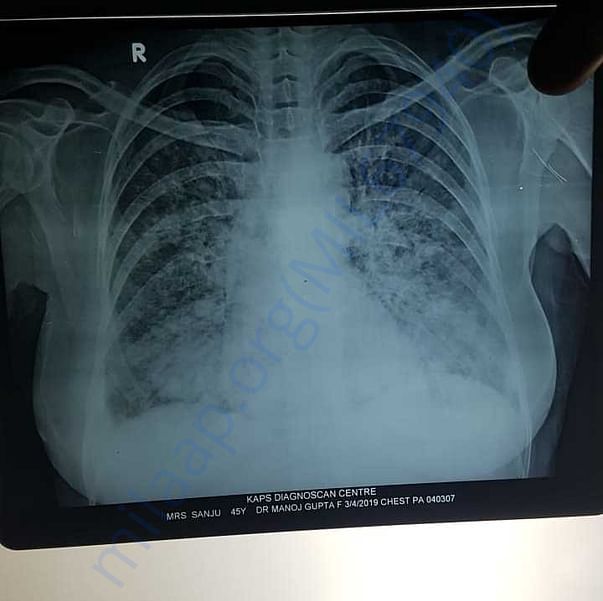 Medical Report