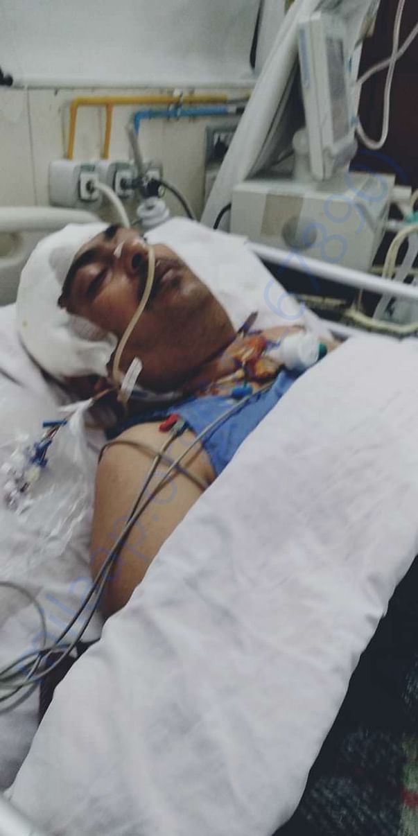 Just now got the opportunity to see my brother. Have uploaded the imag