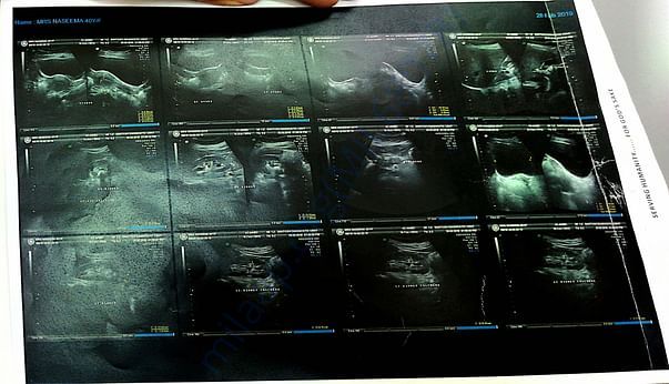 Scan report