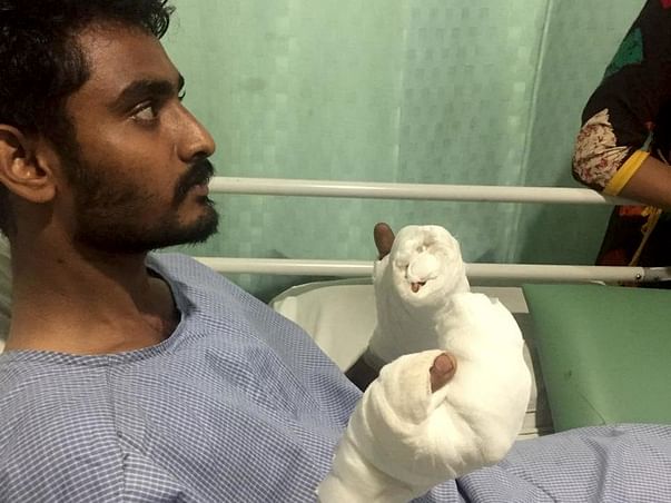 Help Roshan Recover From An Accident