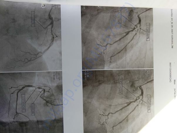 Angiography report
