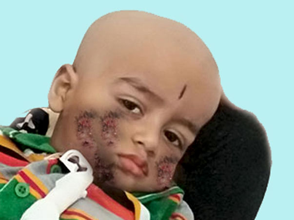 Help My Child Who Fight With His Disease To "Alive"