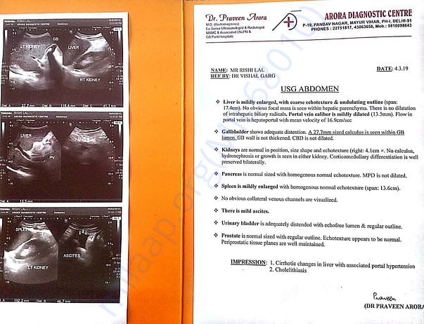 Abdomen ultrasound report