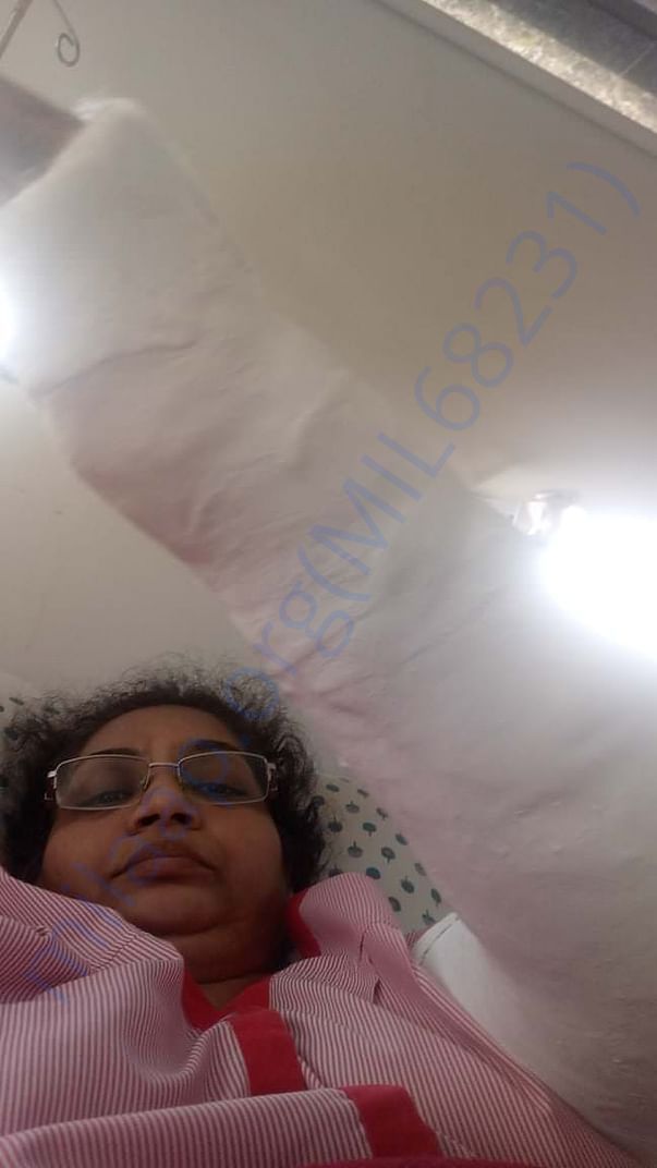 Left hand after operation