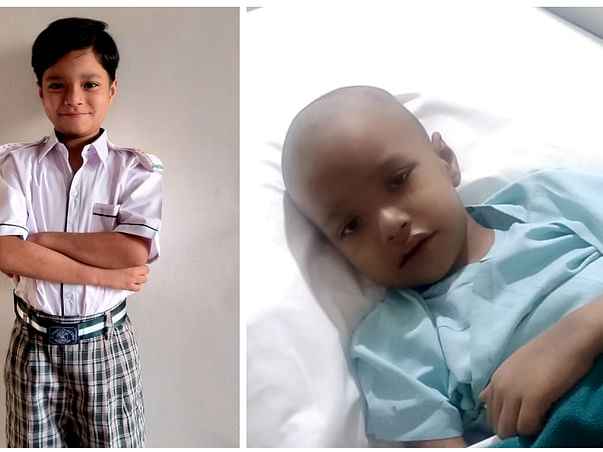 Help 6-year-Old Baabu Get Bone Marrow Transplant