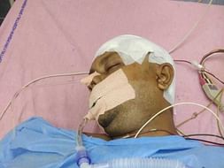 Help My Friend Undergo A Head Surgery