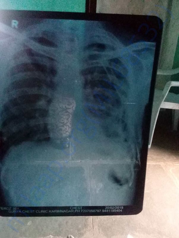 x-ray