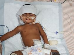 This 1-Year-Old’s Hands And Legs Will Be Amputated Because Of Gangrene