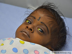 Oviya needs your help to undergo Liver transplant