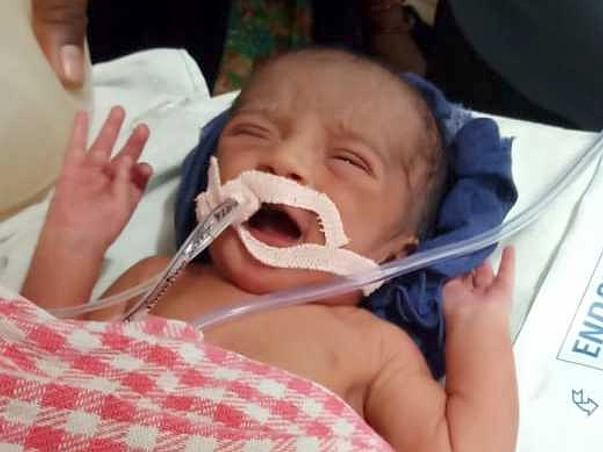 Help 1-day-old Baby Recover From Respiratory Issues