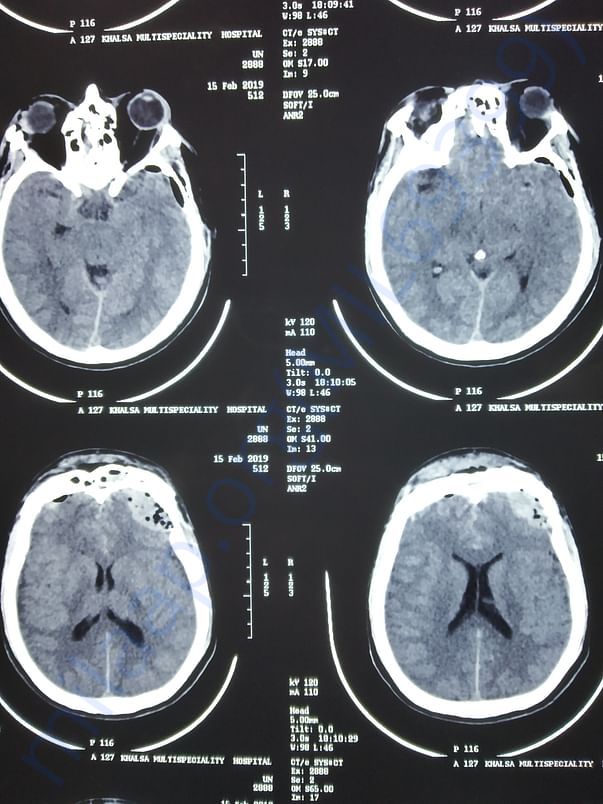 Ct scan showing multiple injuries