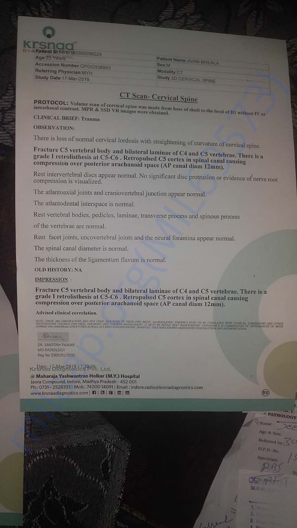 CT scan report