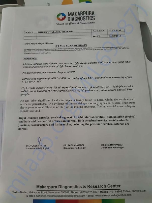 Brain MRI report