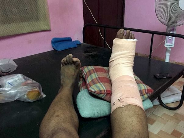 Help Me Complete My Leg Surgery