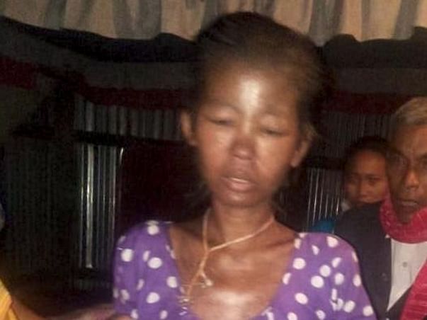 Help Pinki Recover from Kidney failure