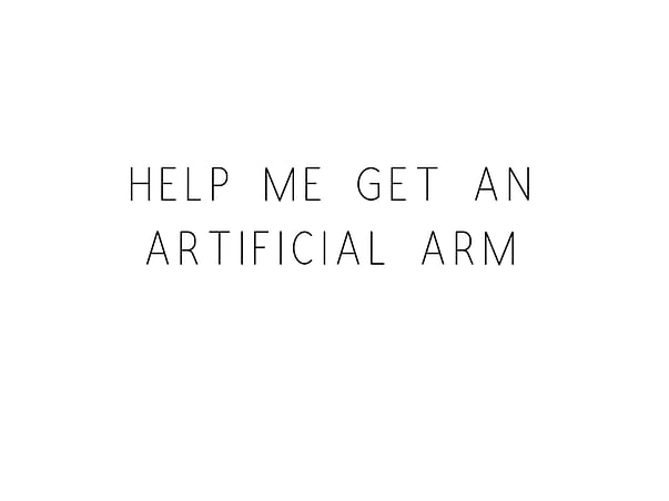 Help Me Get An Artificial Arm