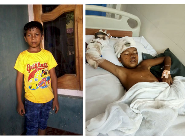 Run Over By A Truck, 9-Year-Old Boy Has No Family To Help Him