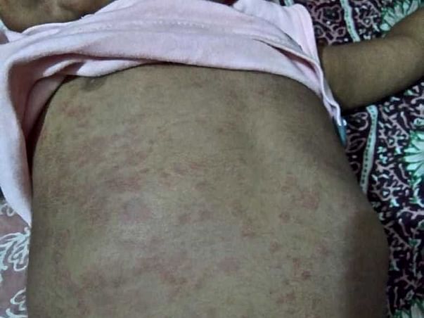 Ehan needs your help to undergo his treatment
