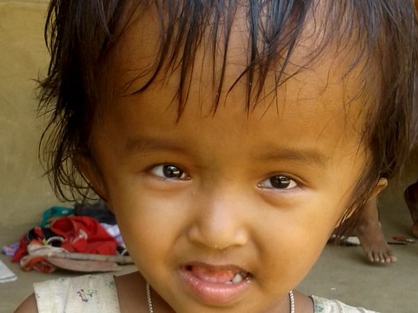 Help 4 Year Old Reshmi Fight Hydrocephalus