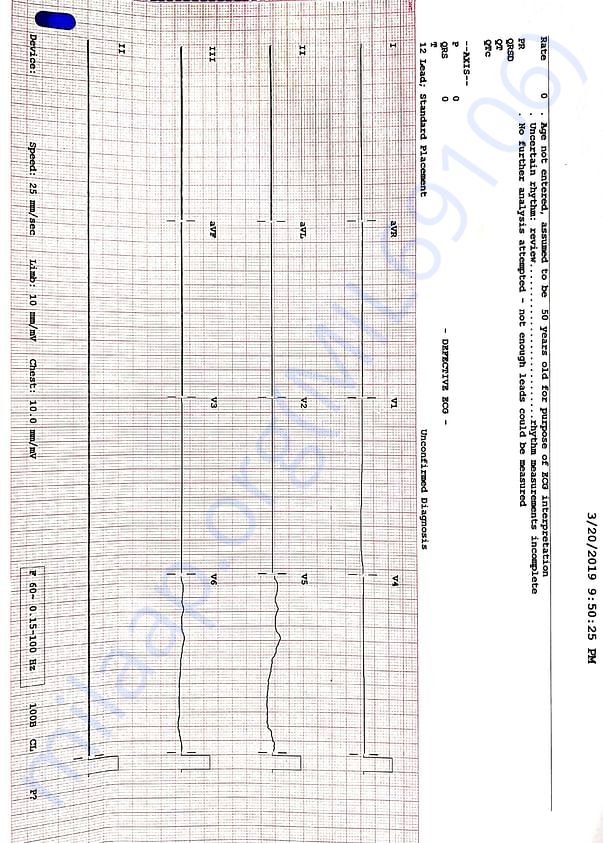 LAST ECG