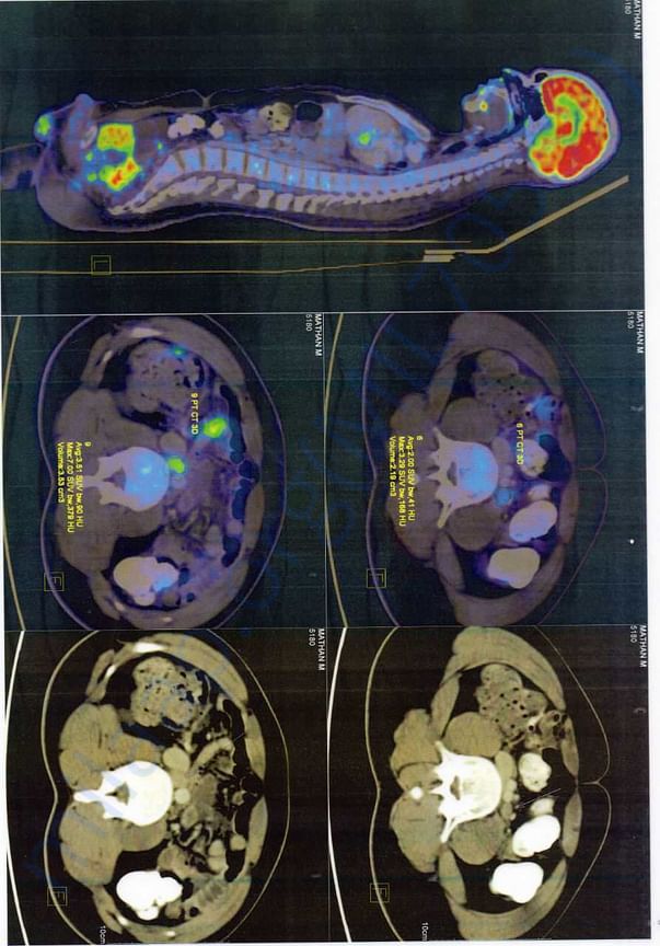 X-ray