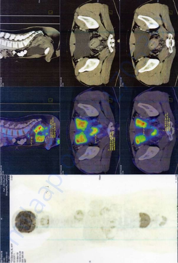 Scanning Document