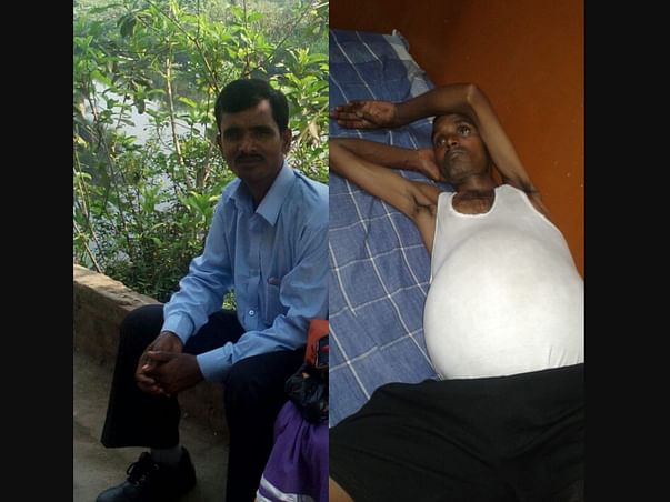 Help Mukhesh Undergo Liver Transplant