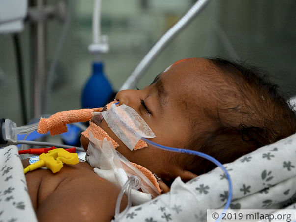 Help 5-month-old Who Had Seizures And Is The ICU With Brain Fever