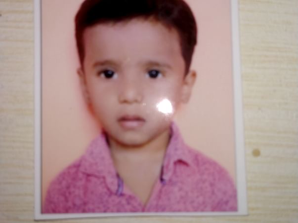 Help Baby Sumant For Cochlear Implant