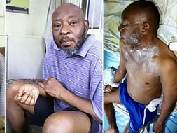 Help Prince James Peters fight Kidney Failure