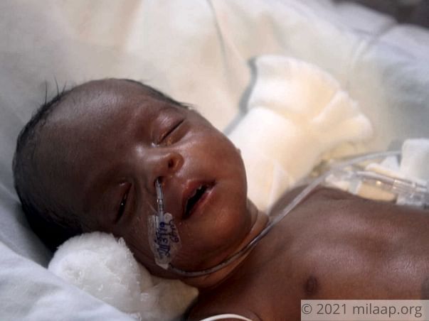 Twin Babies of Jeyakumari Premature needs your help to survive