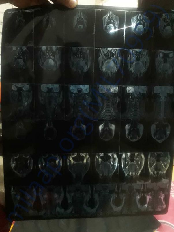 X Ray