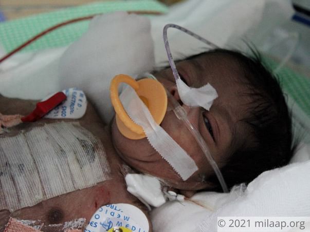 Baby of Lavanya needs your help to survive