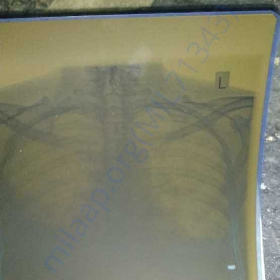 Medical Report