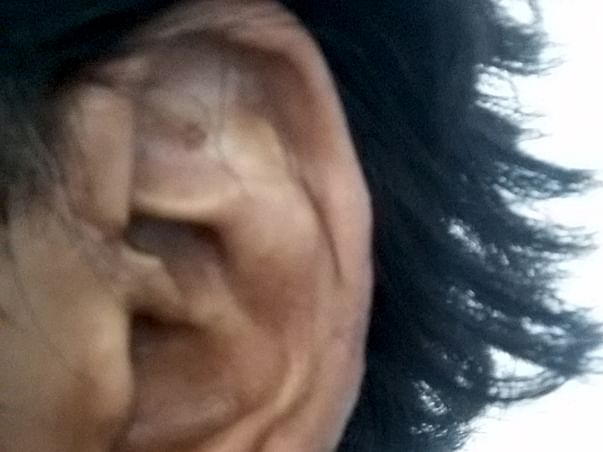 Help Mohd for Ear surgery