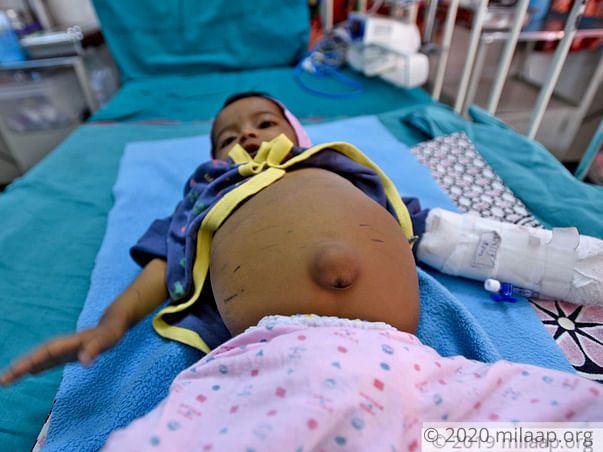 11-Month-Old Baby Girl With 80% Damaged Liver Needs Transplant