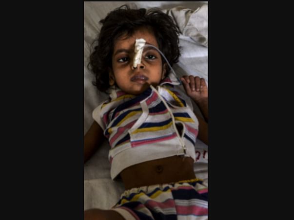 Help 2 Year Old Gopika Fight Blood Cancer
