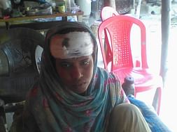 Multiple Injuries on the Head