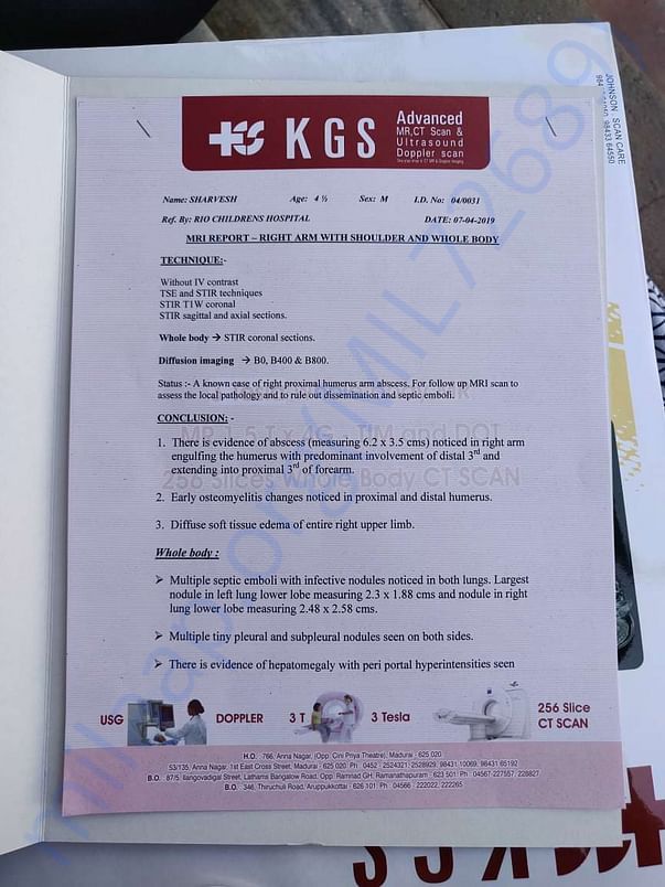 MRI Scan report