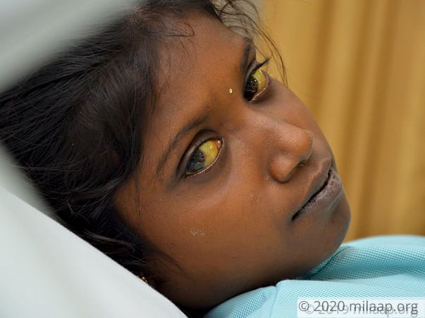 Sivaranjini needs your help to undergo Liver transplant