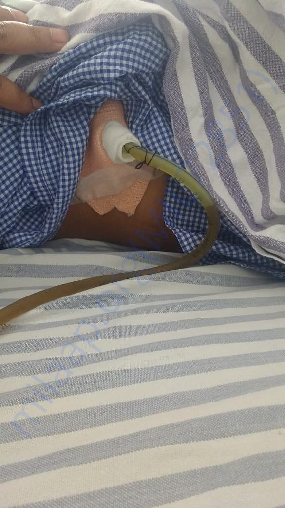 Latest condition, Still leaking of liquid. Drs hopefulof recovery
