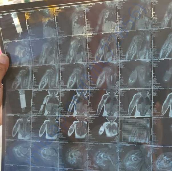 Medical Report