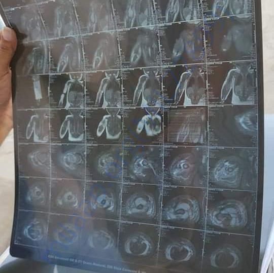 Medical Report