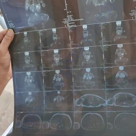 Medical Report