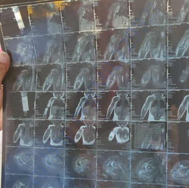 Medical Report