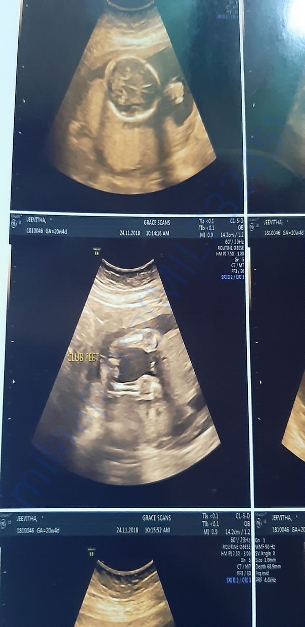 My son leg scan report