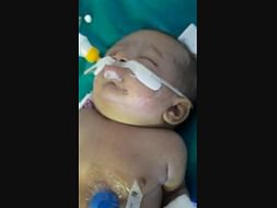 Help My 9 Week Old Baby Recover