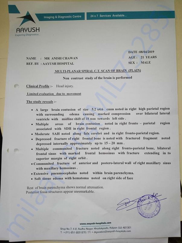 CT scan Report