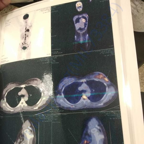Medical Report